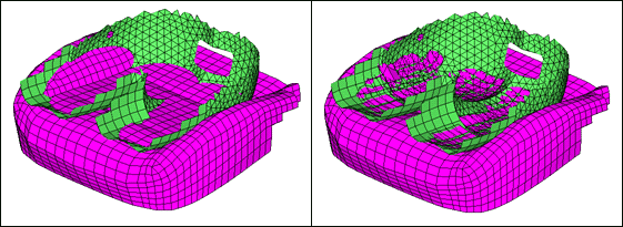 beforeafter_pelvis